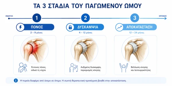 Τα τρία στάδια του παγωμένου ώμου